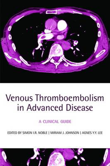 Picture of Venous Thromboembolism in Advanced Disease: A clinical guide