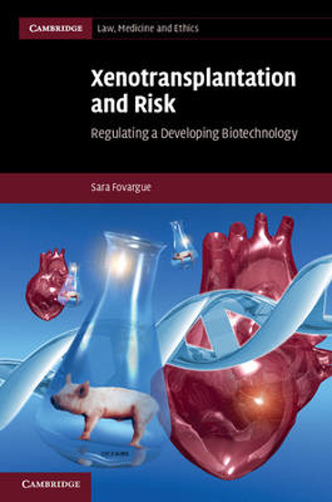 Picture of Xenotransplantation and Risk: Regulating a Developing Biotechnology
